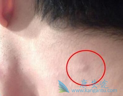 �ܰͰ���֢״