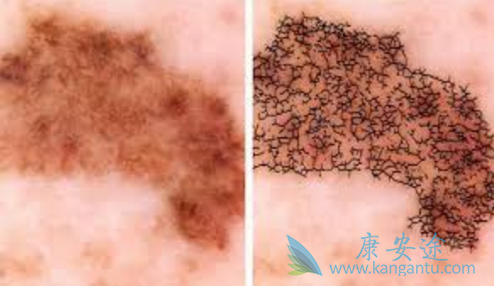 ��ɫ�������������