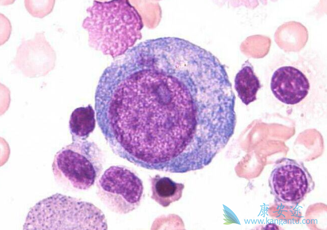 ���������쳣�ۺ���