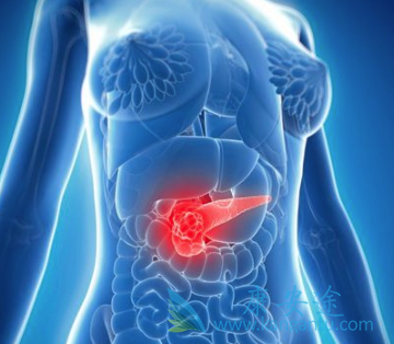 �������ٰ�