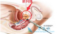 ֱ��ָ���Ǽ��ǰ���ٰ�֢����Ч�ֶ�֮һ