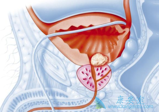 ǰ���ٰ��ܻ���