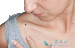 ����Ƥ����֢״Ӧ������̬�仯����