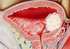 ���װ�����ʱ���װ�֢״����Щ