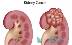 ����֢״�����ڷ����ڻ������Щ����