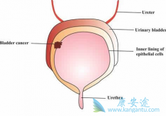 ��Ī¬����(Cyramza)����������·��Ƥ������Ч������PD-1�����Ʒ�