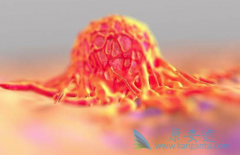 ��֢�����ܻ����ǰ�֢���߱ȽϹ�ע������