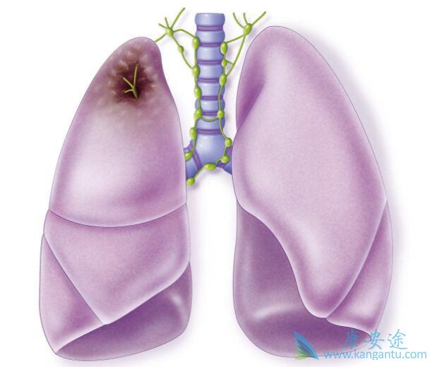 �ΰ���ת��֢״