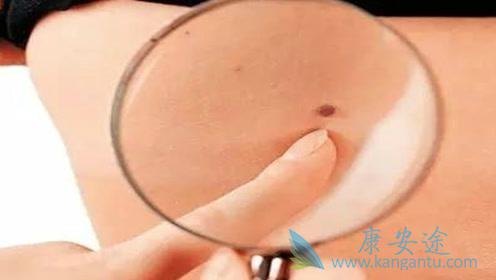 海外医疗 海外医疗