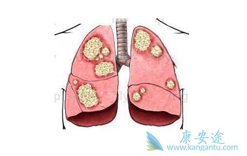 Ԥ���ΰ�����