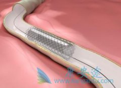 ����ҽ�Ƹ�������Ĳ�������������֧�����ָ��ã�