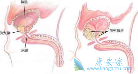 ����³��