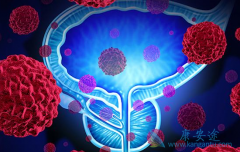 ǰ���ٰ�����Խ��ʹ������/��������(Zytiga)����Խ��