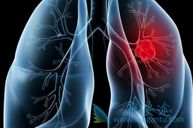 �ΰ�����֢״