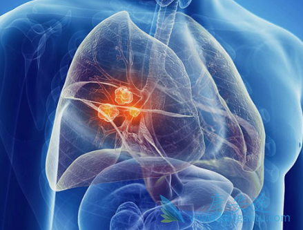 �ΰ�����֢״