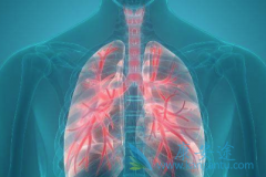 �ΰ����ڴ�Ⱦ�𣿷ΰ���ν�������