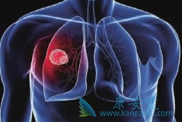 �ΰ���������