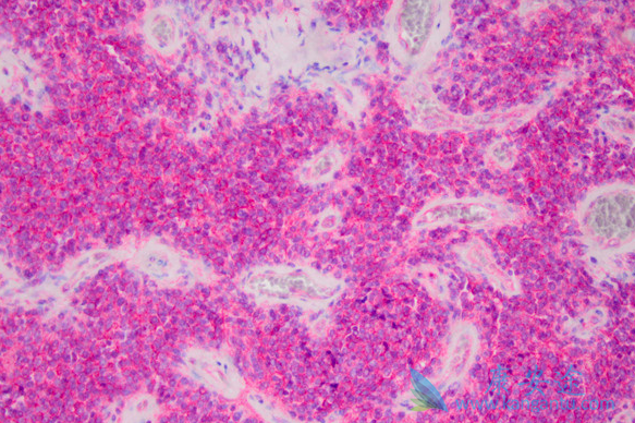 �������ὺ��