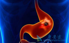 ��Ī¬����(Ramucirumab)����ɼ������������ת����θ����������