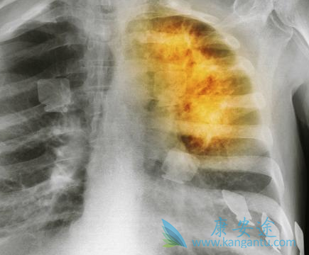 �ΰ����ڻ��о���