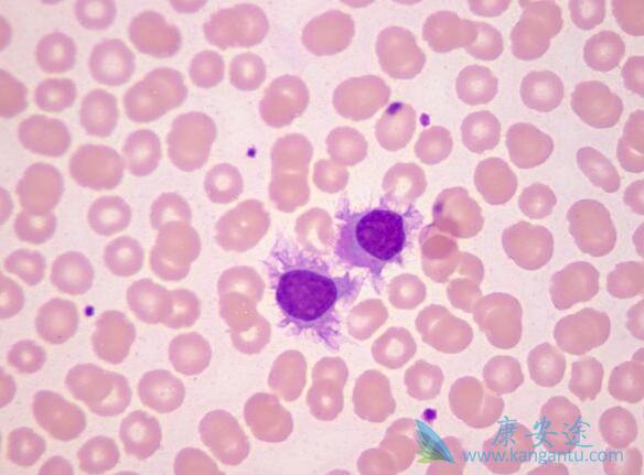 ����Bϵ�ܰ�ϸ����Ѫ��