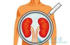 ��������(Cometriq)�����������������ӳ��������ߵ�PFS