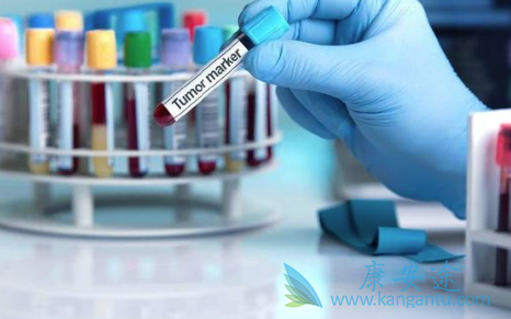 �ΰ���������ƫ��