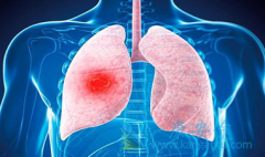 ӡ�����޿�˵�����������ĸ���������Щ����Ҫ������