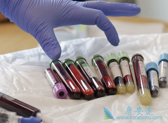 CARTϸ������