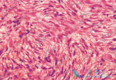 ¡ͻ��Ƥ����ά������һ��ԭ����������������Ƥ������