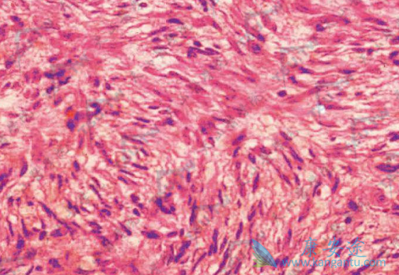 ¡ͻ��Ƥ����ά����