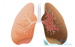 PD-L1���Ƽ�durvalumab���׸�����Ԥ���ΰ�������ҩ��