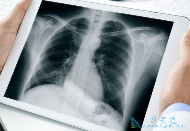 �ΰ�������