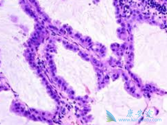 非小细胞肺癌 非小细胞肺癌