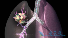 ���ڷΰ���������Ч�����ڷΰ������ֶ���ʲô��