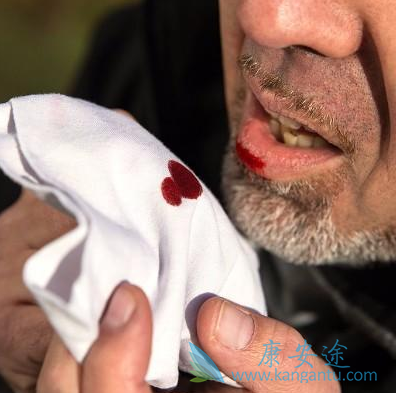 小细胞肺癌生存期 小细胞肺癌生存期