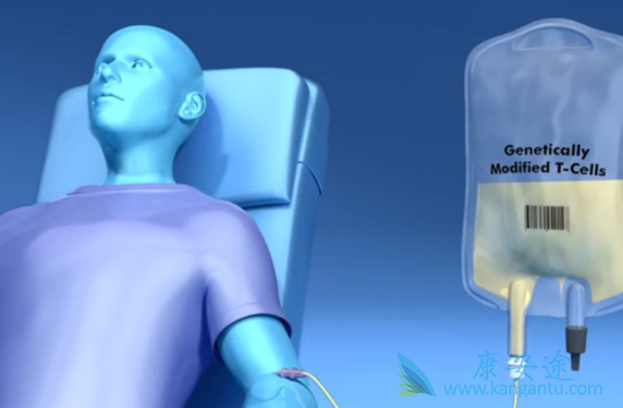 CART细胞疗法 CART细胞疗法
