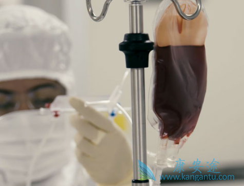 CART细胞 CART细胞