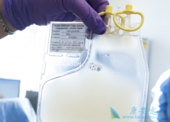 CARTϸ�����Ƶ�ԭ����ʲô��CARTϸ�����ƻ����Է�Ϊ�����ͨ�õ�����