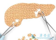 ���ٰ�֢״�����ڻ�����Щ�������