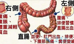 �������ֱ��ظ�ʹҪ�����Ǵ󳦰�֢״