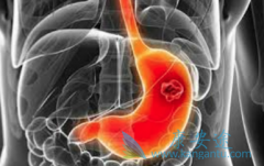 ����û��ʳ���Բ��·������Ű�֢״��һ��