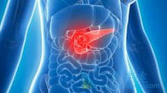 ����pNET���߷�����������(Sunitinib)����Ŀ����������С10%