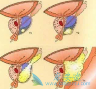 Ϊʲô�����ع��߻���Ҫֹͣʹ�ð�������(XBIRA)