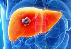 �Ż�����ԭ���Ըΰ��Ĵ�ͳ���Ʒ���