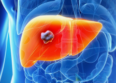 �ַ�����(lenvatinib)III������ɹ����ı��ҹ��ΰ�������״