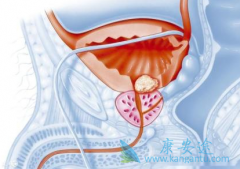 ��������(XBIRA)�ɸ���δ�����Ƶ�CRPC���ߵ�X���������޽�չ������