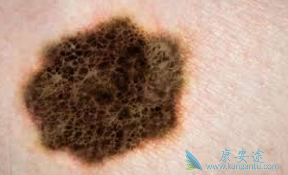 ��ķ����