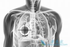 ���������Ƿΰ��۰����ǿ����õķΰ�ҩ����Щ��