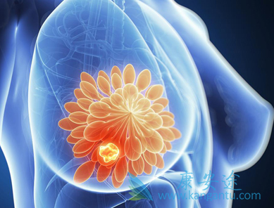 �����׷�